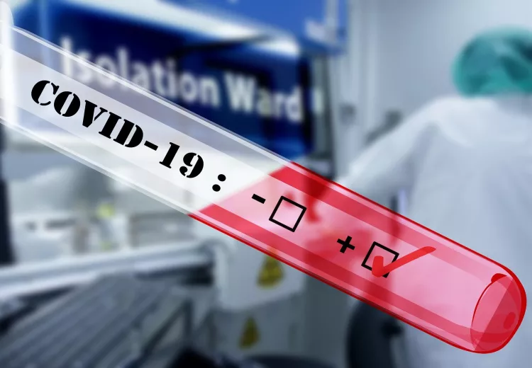 BioSample autotest COVID
